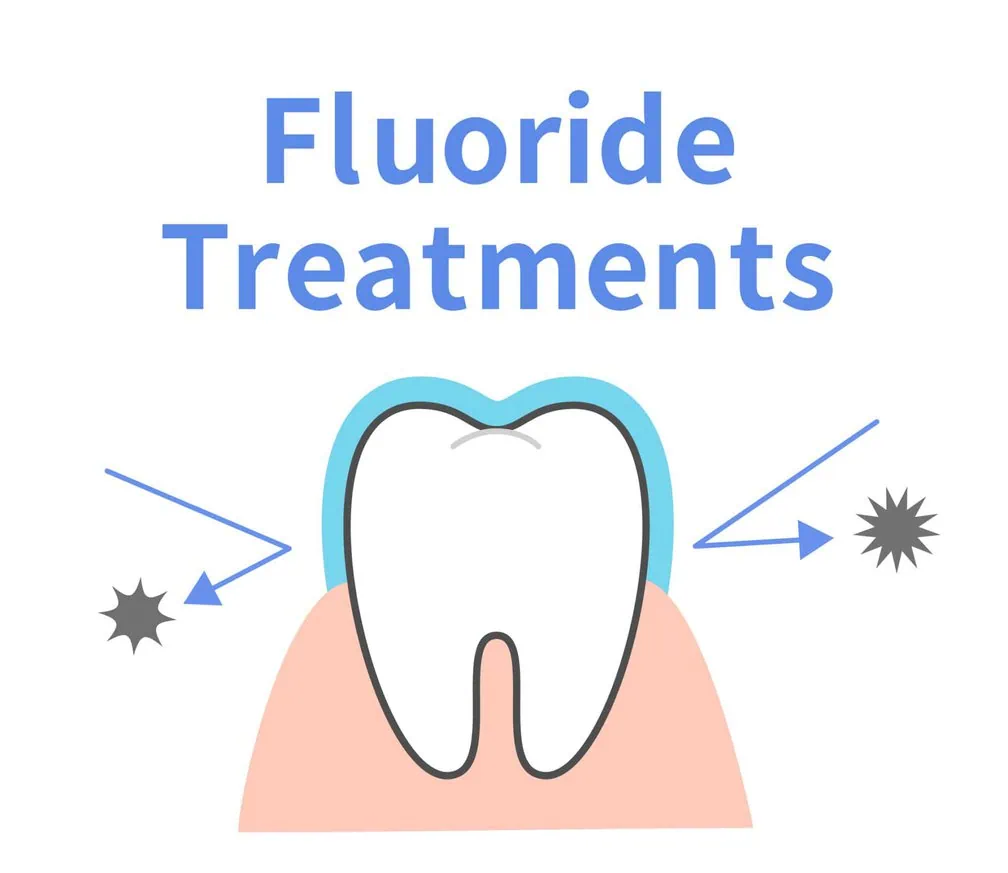 Fluoride treatment