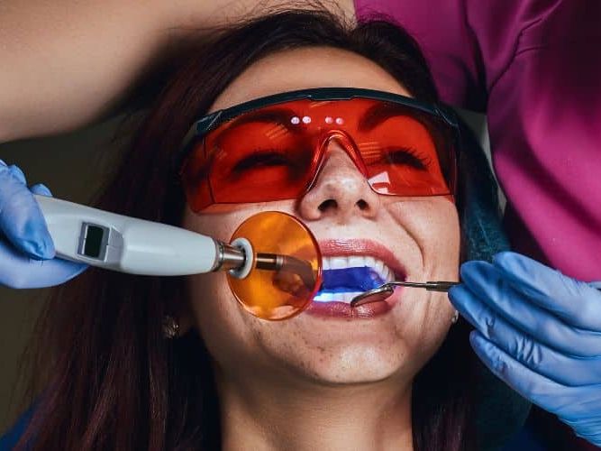 Fluoride treatment illustration