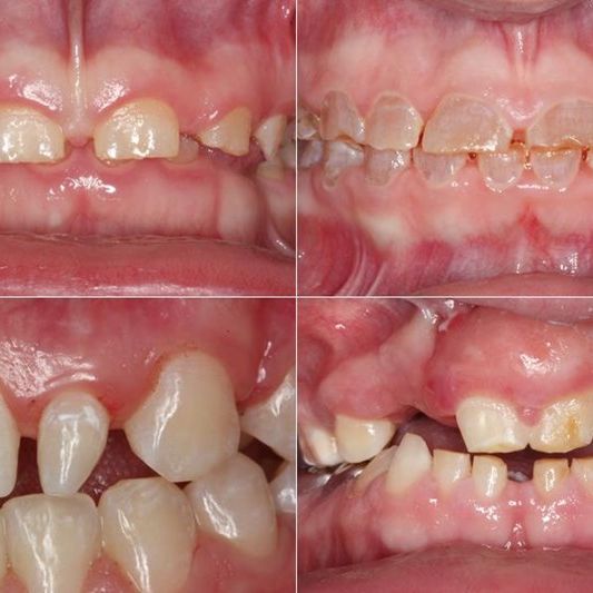 Cosmetic dental concerns preview