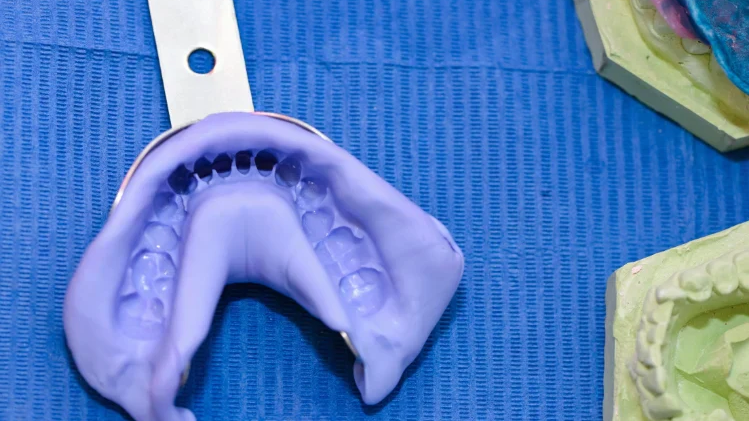 Impressions & Temporaries