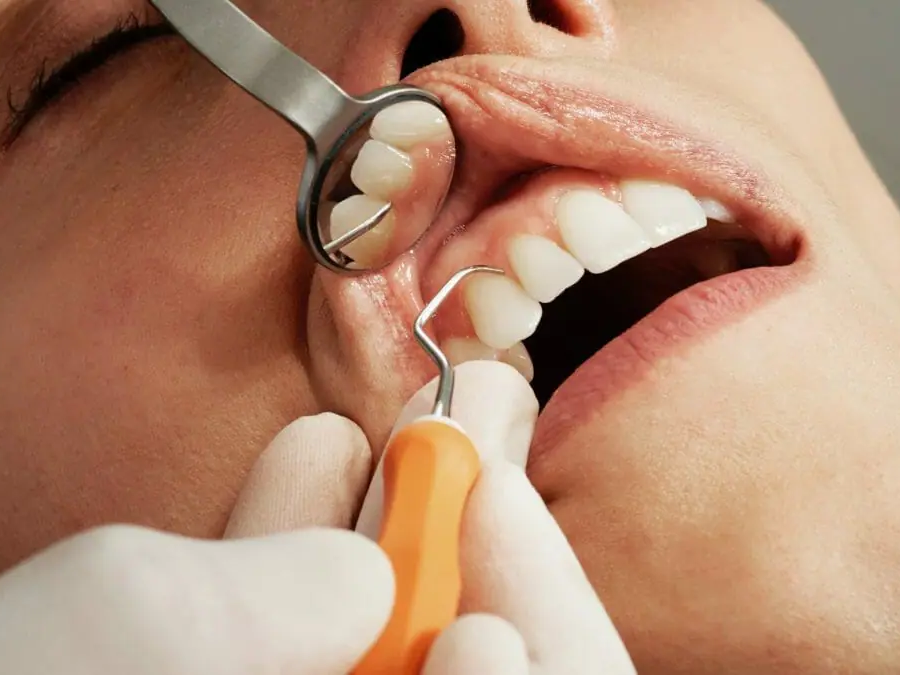 Digital X-ray technology