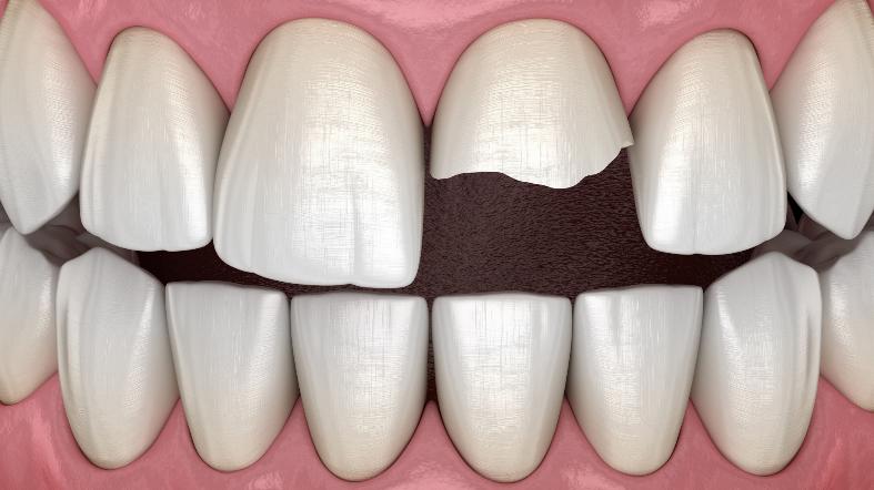 Hero: Emergency dental treatment