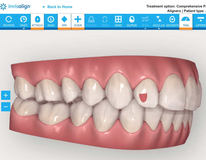 3D Treatment Plan demo